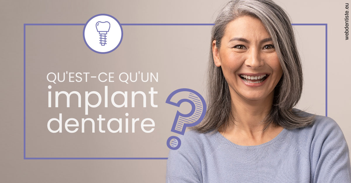 https://www.dr-bonan-stephanie.fr/Implant dentaire 1