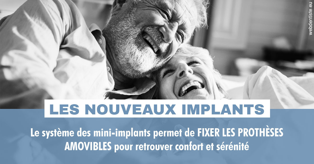 https://www.dr-bonan-stephanie.fr/Les nouveaux implants 2