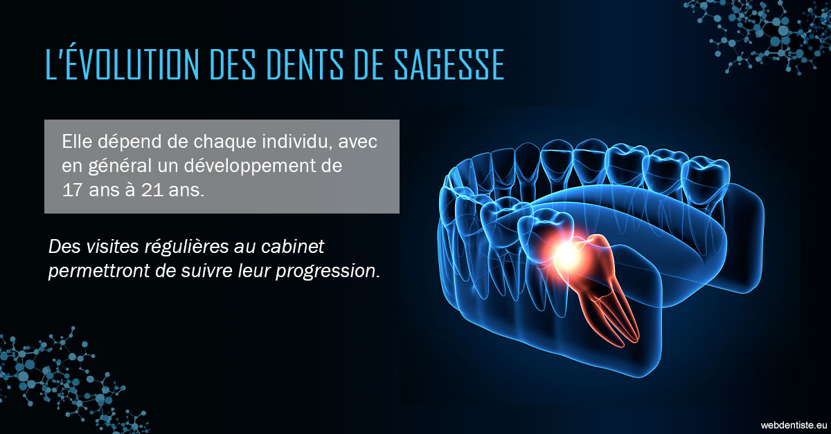 https://www.dr-bonan-stephanie.fr/2023 T4 - Dents de sagesse 01