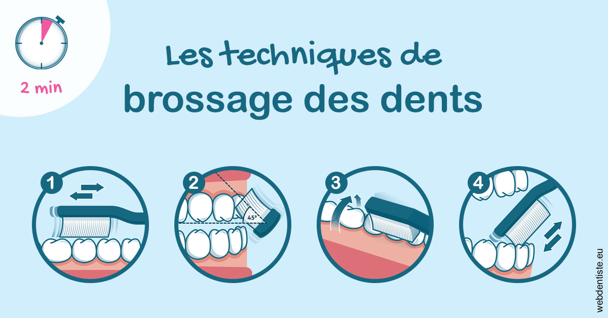 https://www.dr-bonan-stephanie.fr/Les techniques de brossage des dents 1