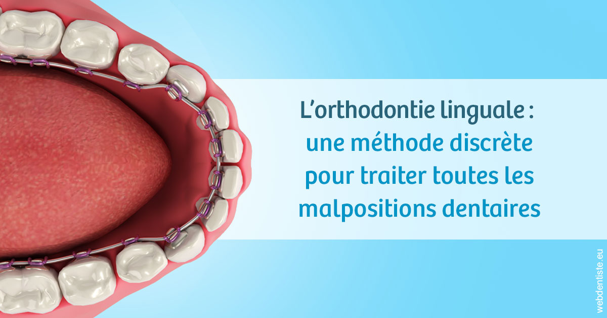 https://www.dr-bonan-stephanie.fr/L'orthodontie linguale 1