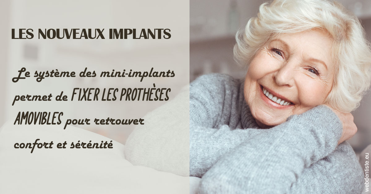 https://www.dr-bonan-stephanie.fr/Les nouveaux implants 1