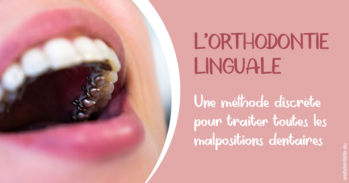 https://www.dr-bonan-stephanie.fr/L'orthodontie linguale 2