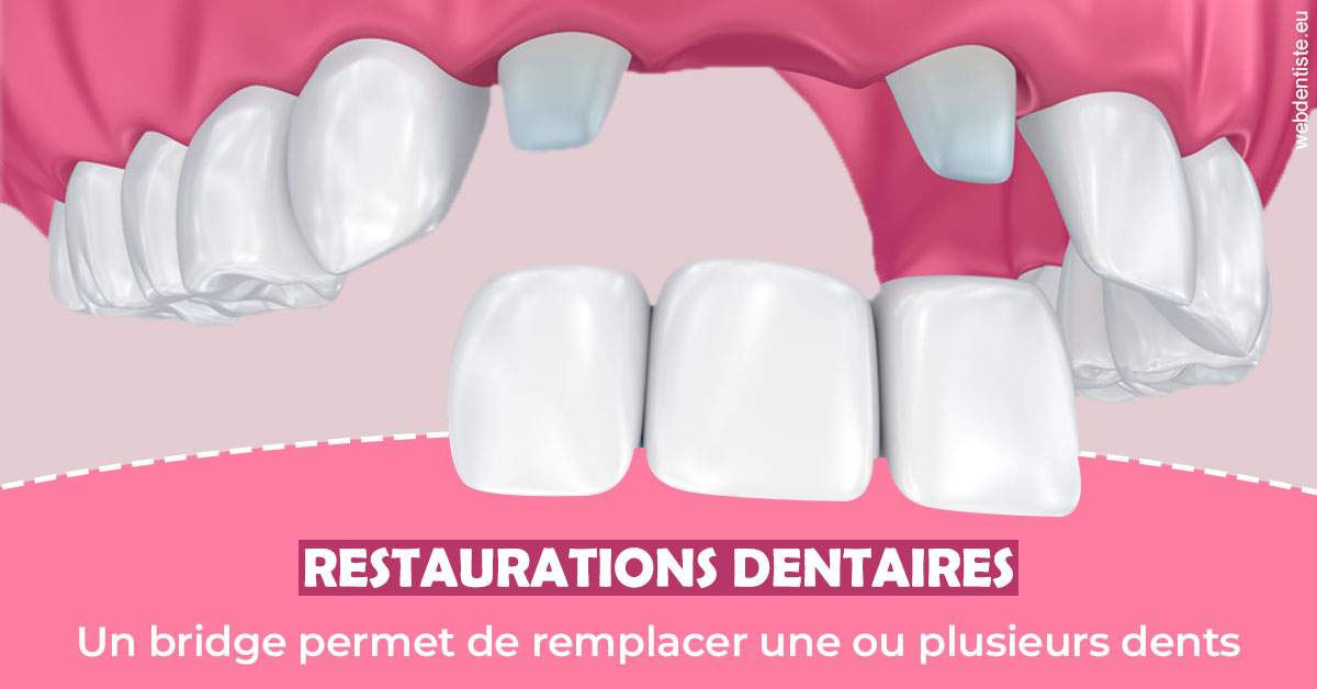 https://www.dr-bonan-stephanie.fr/Bridge remplacer dents 2