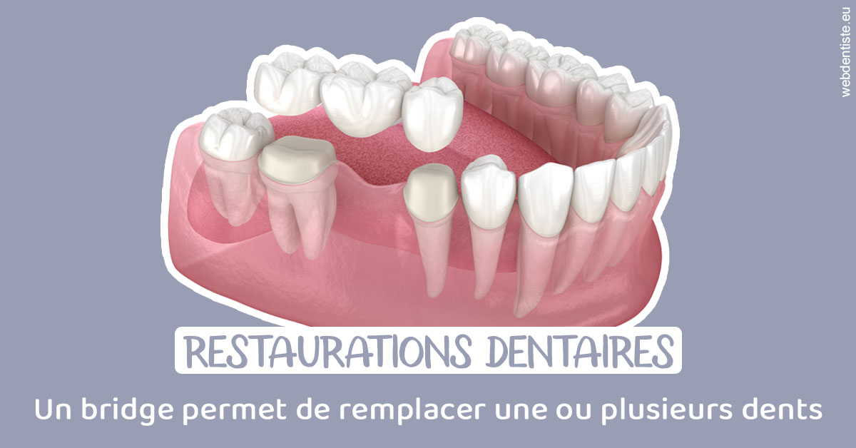 https://www.dr-bonan-stephanie.fr/Bridge remplacer dents 1