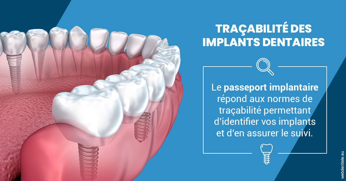 https://www.dr-bonan-stephanie.fr/T2 2023 - Traçabilité des implants 1
