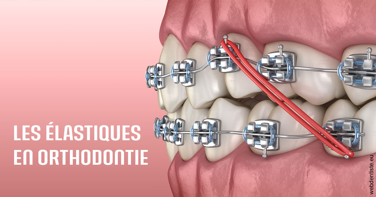 https://www.dr-bonan-stephanie.fr/Elastiques orthodontie 2