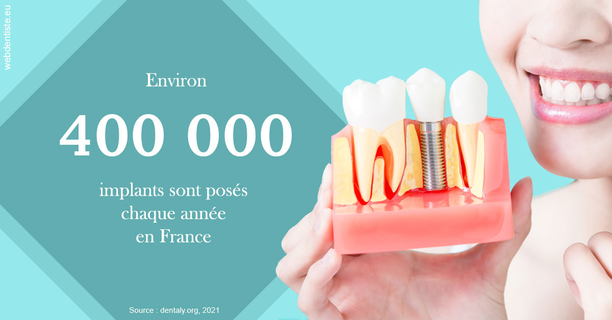 https://www.dr-bonan-stephanie.fr/Pose d'implants en France 2