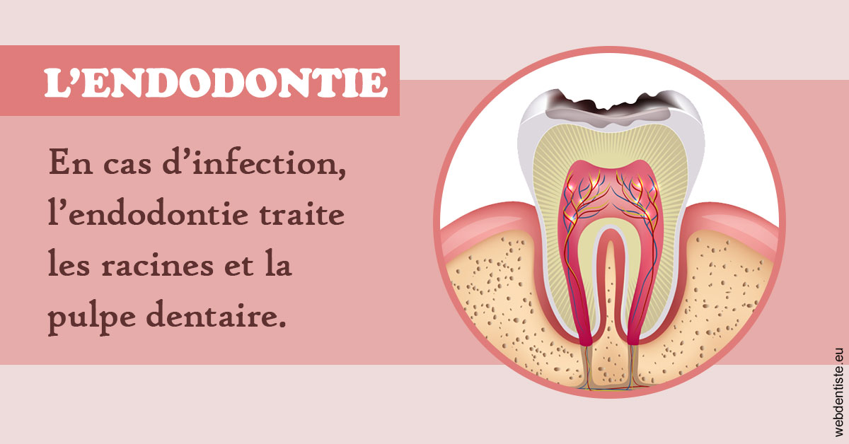 https://www.dr-bonan-stephanie.fr/L'endodontie 2