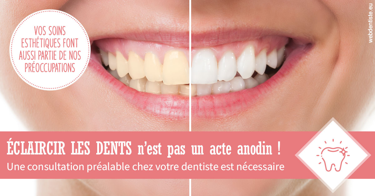 https://www.dr-bonan-stephanie.fr/Eclaircir les dents 1