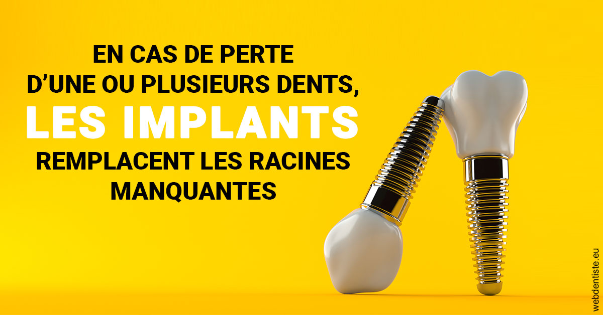 https://www.dr-bonan-stephanie.fr/Les implants 2